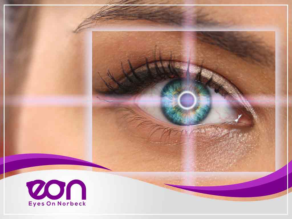 Common LASIK Surgery Myths and the Truth Behind Them